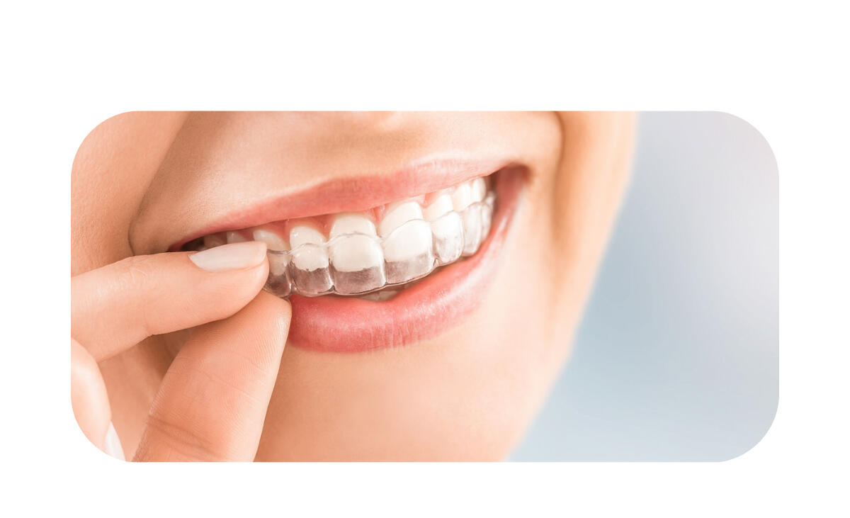 Лечение с Алайнери